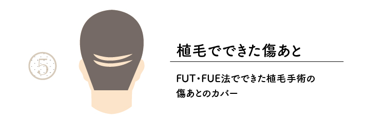 範囲5植毛の傷跡