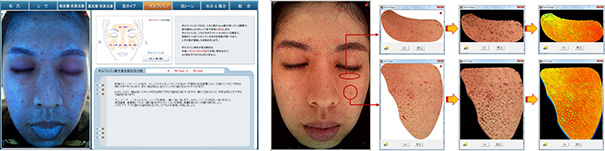 測定値の詳細を示した様子