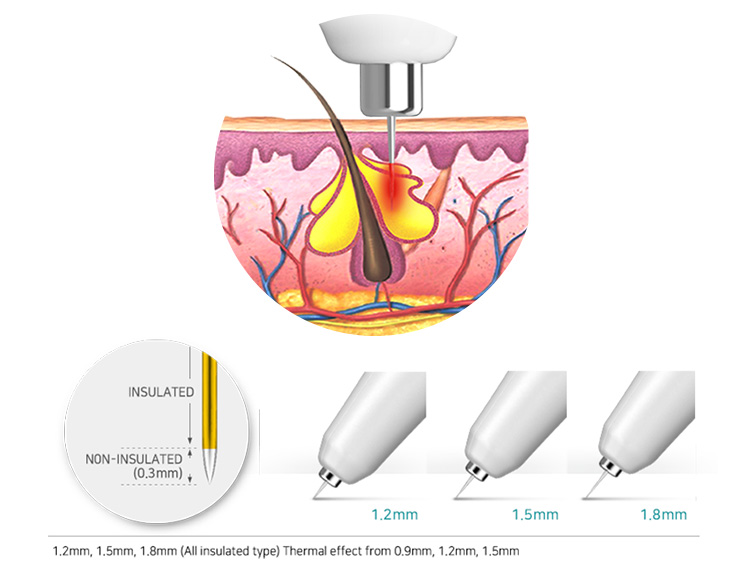 ジェントロアクネスニードルのイメージ画像