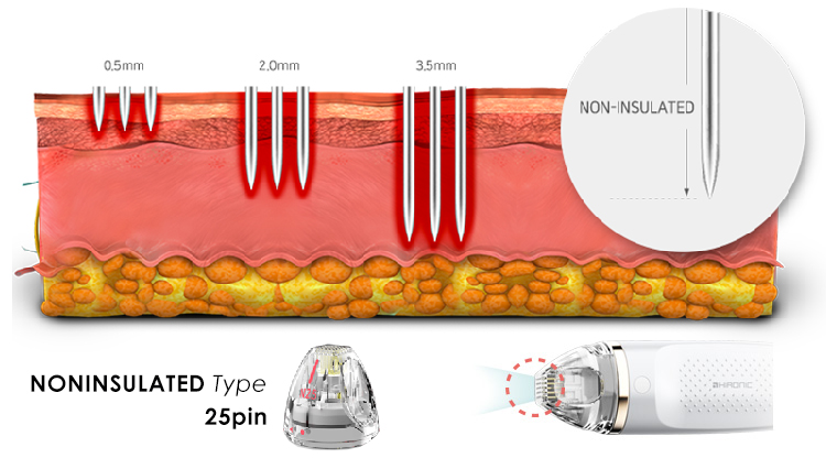 ジェントロアクネスマルチニードル