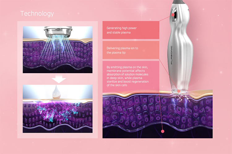 プラズマ治療の機械と肌のイメージ画像