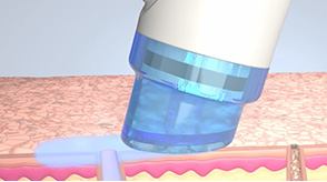 ディープクレンジング+ピーリングのイメージ画像