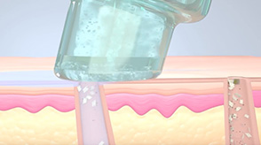 美容液導入+保護のイメージ画像